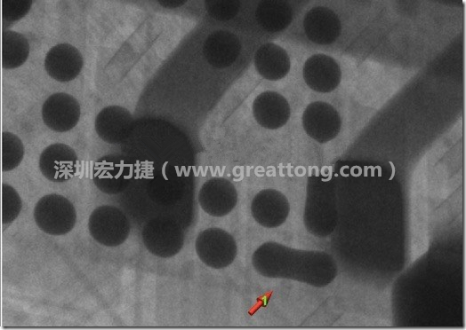 BGA因?yàn)楹笁|變小，造成錫膏過多而最終形成焊接短路的結(jié)果。